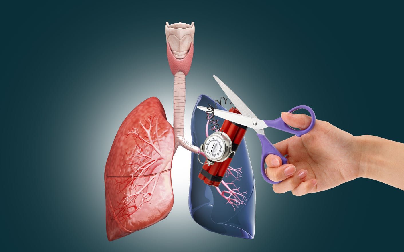 慢阻肺患者人数约1亿 专家呼吁规范使用药物吸入装置