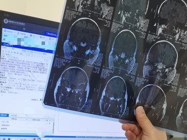 我們的記憶力有救嗎？探訪(fǎng)記憶門(mén)診