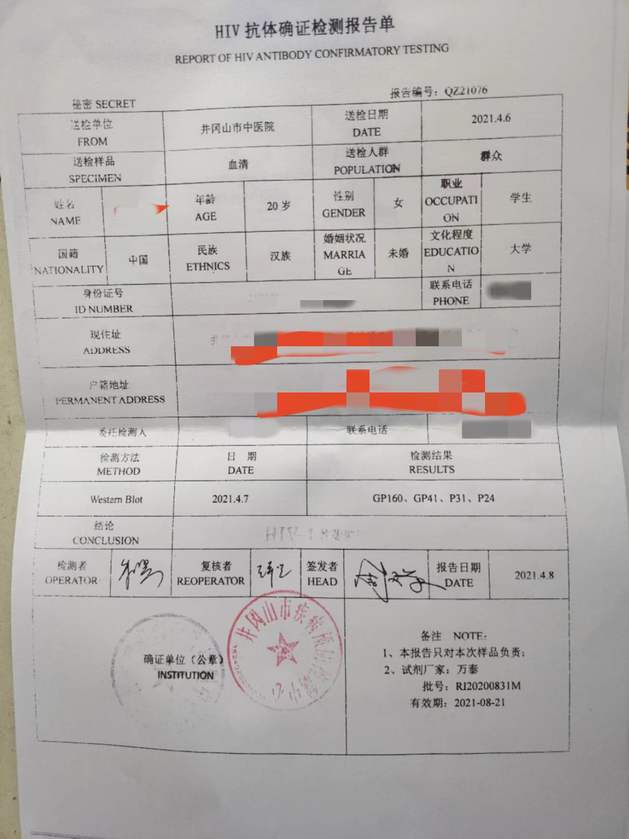 在陳青父親提供的一份名為《hiv抗體確證檢測報告單》中,檢測結論一項