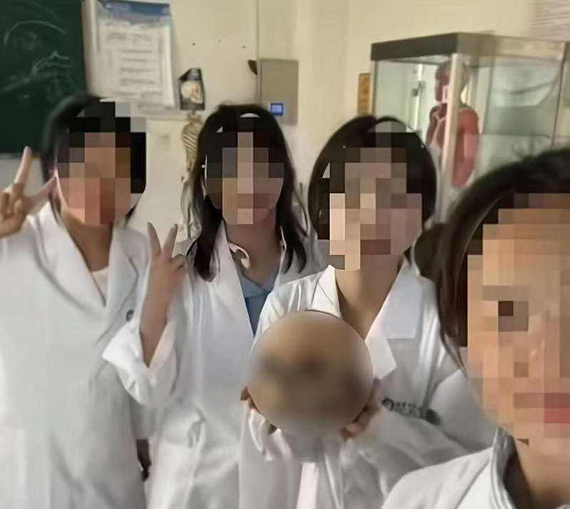 晒与遗体救济者头骨的合影，医学生不能“冷清舍身”