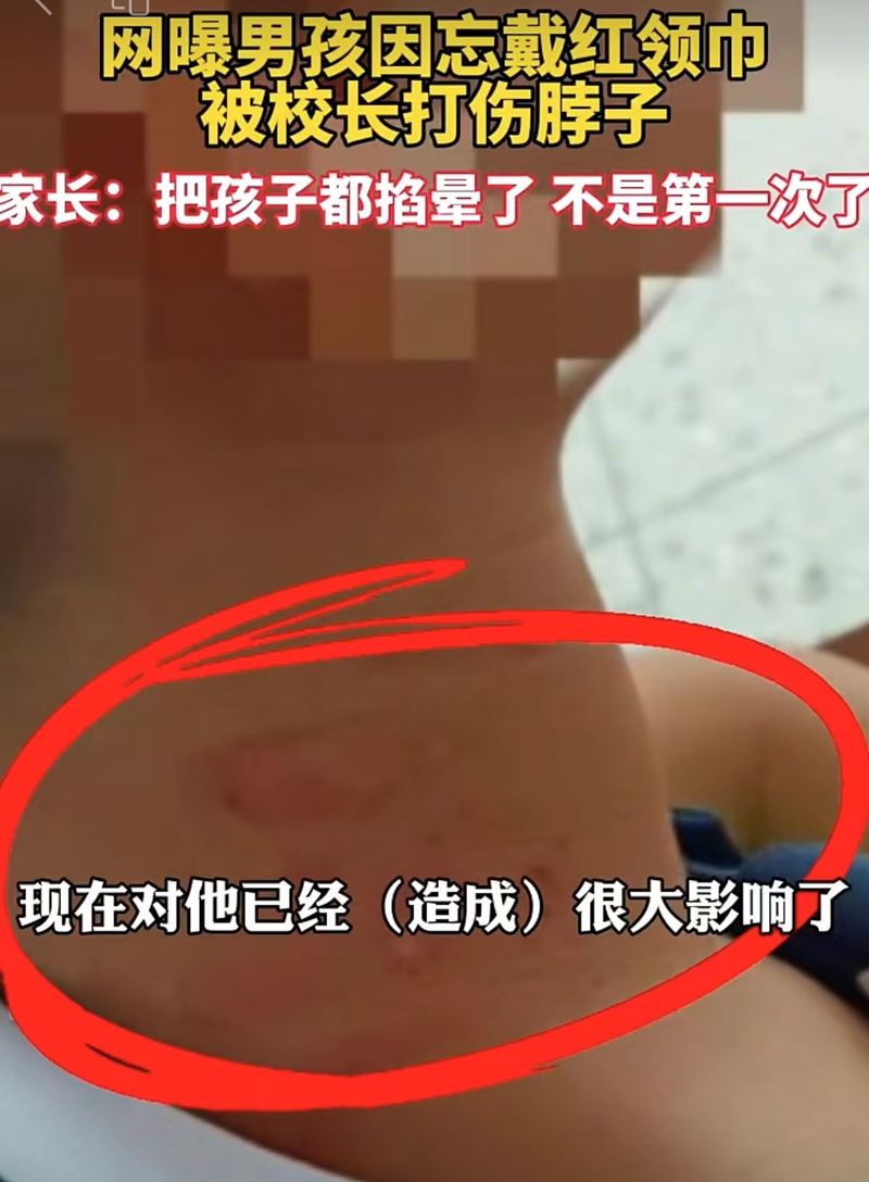 男孩未戴红围巾被校长掐脖，这不是体罚而是滥施暴力