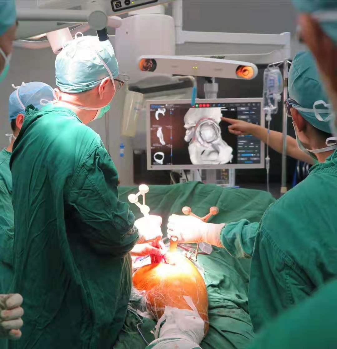 国产单臂手术机器人完成首例临床入组，独特设计切口更小、对组织侵袭更少_健康 _ 文汇网