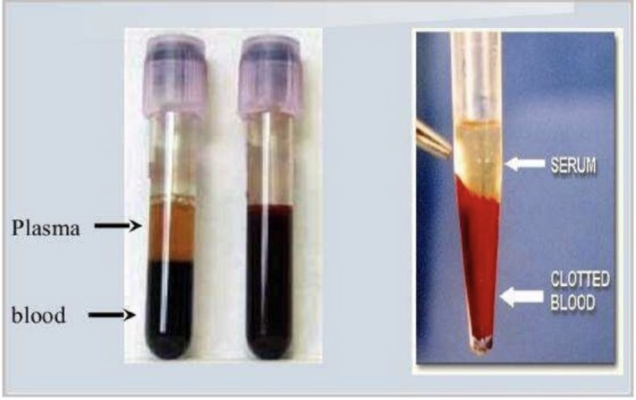 左侧上方是血浆（plasma），右侧上方是血清（serum）。图/中国科学院科普云