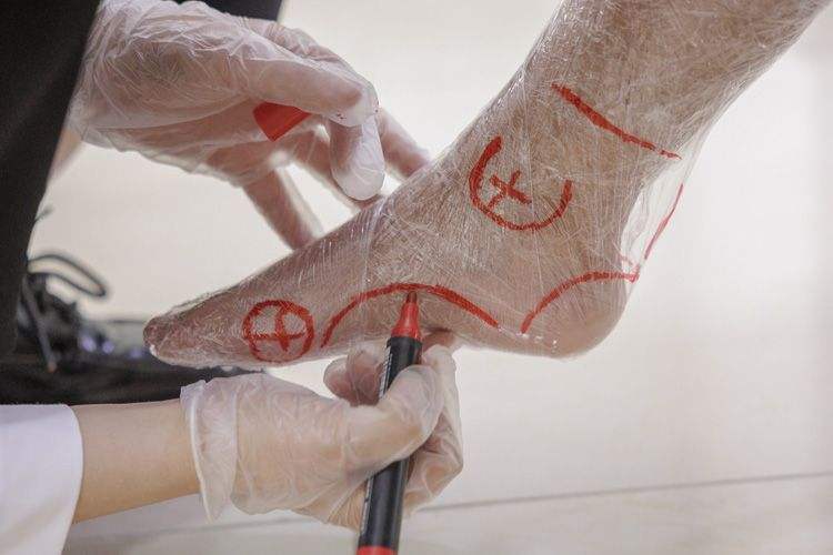 假肢矫形痊愈师：“00”后姑娘的匠心之路 — 新京报