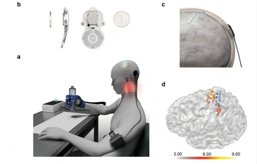 国内首款侵入式脑机接口获批上市，数百万脊髓损伤患者有望受益