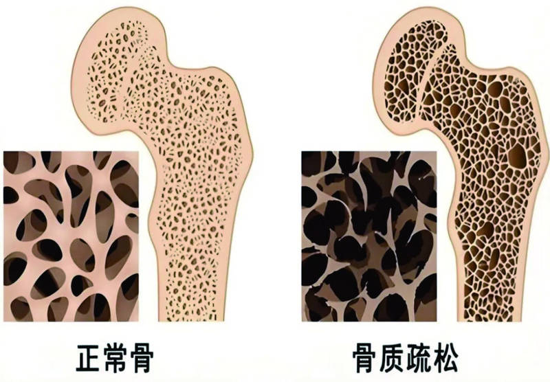 科学与健康 认识骨骼：双结构养护，骨骼更健康 — 新京报 