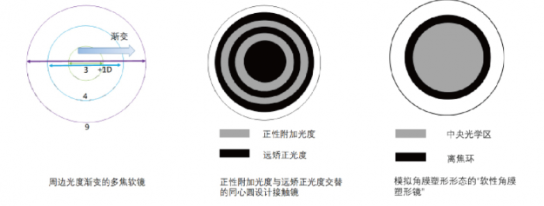 什么是软式内镜镜离焦软镜：谁适用？效果如何？注意事项全解析_https://www.jmylbn.com_新闻资讯_第1张