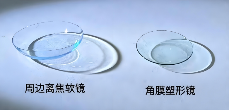 什么是软式内镜镜离焦软镜：谁适用？效果如何？注意事项全解析_https://www.jmylbn.com_新闻资讯_第2张